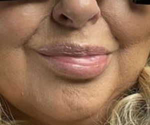 Magda Gessler. To nie botoks, to paraliż!