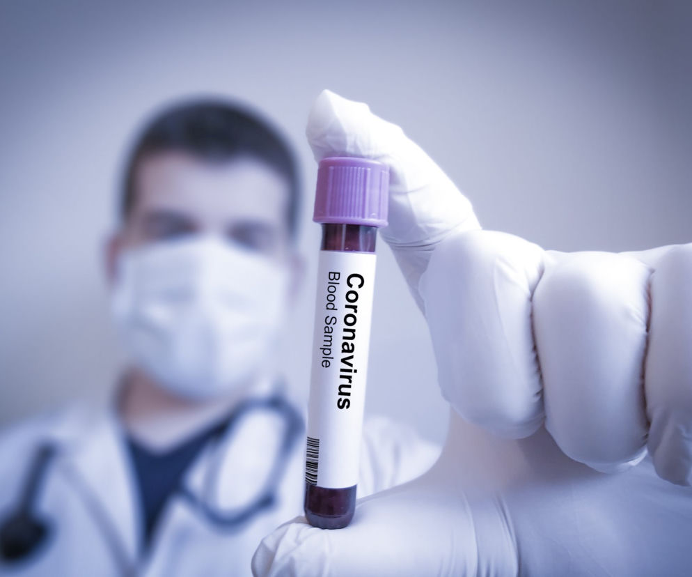 Koronawirus: epidemia w Polsce