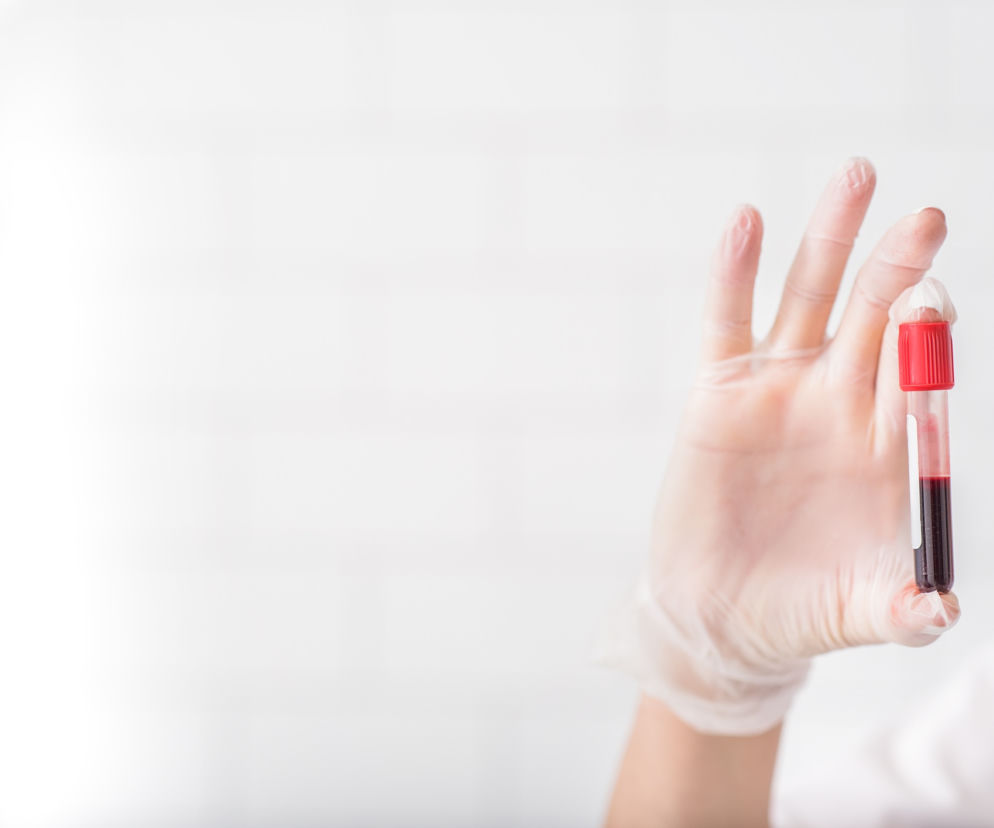 Morfologia i OB - BADANIA KRWI, czyli co się mieści w kropli krwi