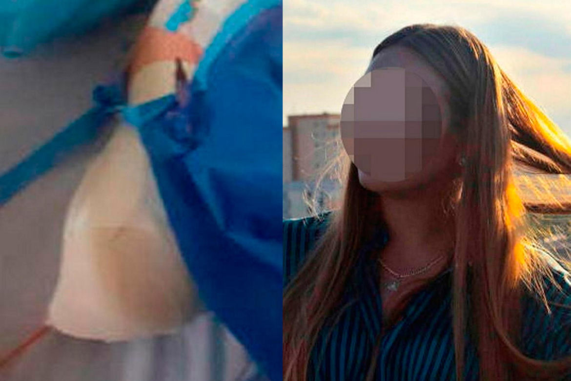 Koszmarny wypadek na wakacjach w Egipcie! Paulina straciła rękę [ZDJĘCIA]