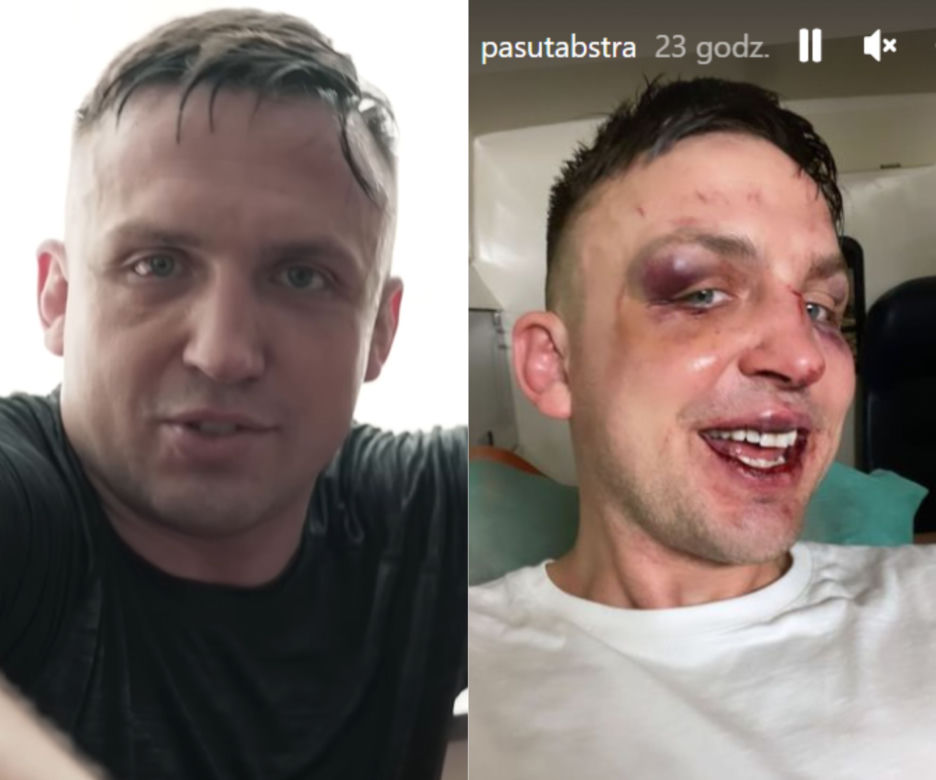 Robert Pasut w trakcie walki na Fame MMA 18!