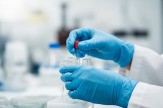 Zakażenie HAV na UW. Jak długo należy się obserwować?