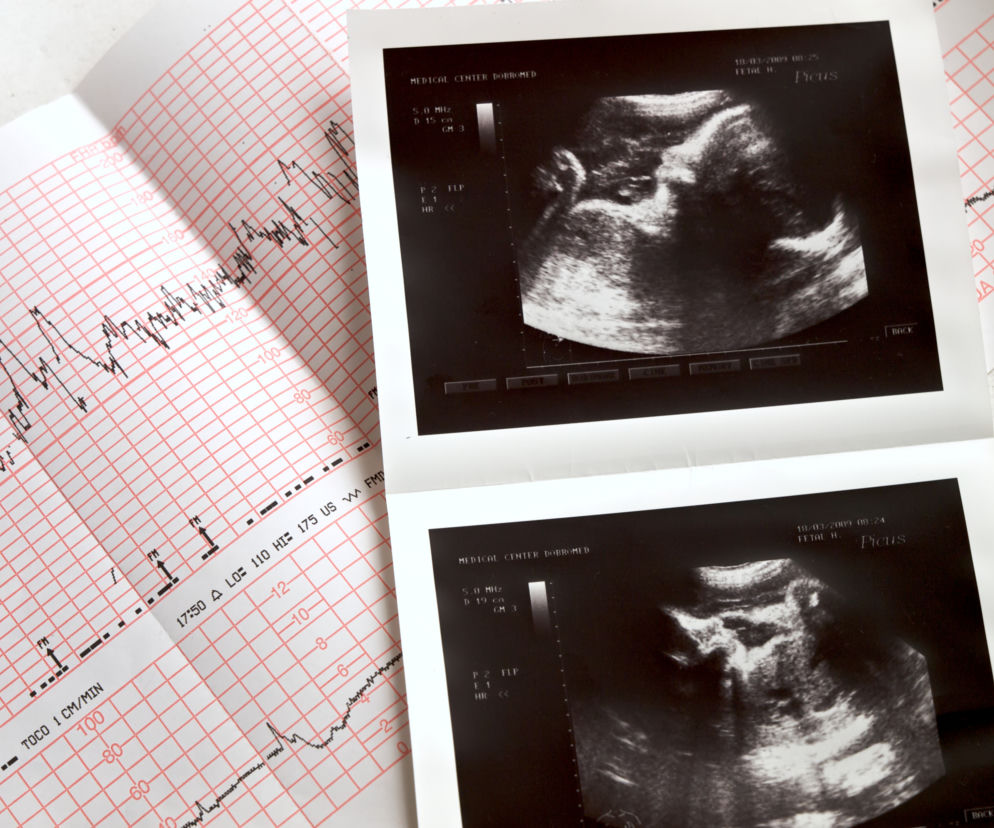 Czy w świetle nowych przepisów wykonywanie badań prenatalnych będzie jeszcze miało sens?