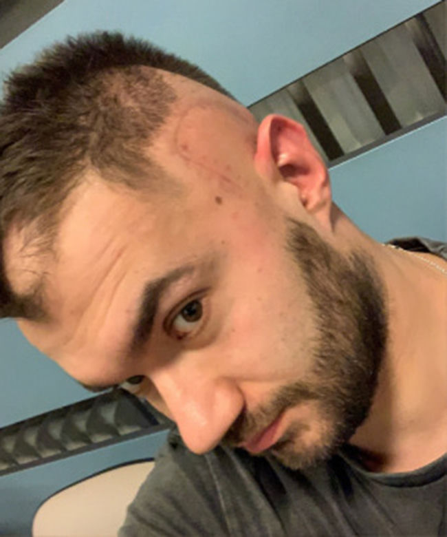 Sebastian rozpoczyna drugą wojnę z glejakiem. Dramatyczny apel o pomoc