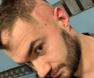 Sebastian rozpoczyna drugą wojnę z glejakiem. Dramatyczny apel o pomoc