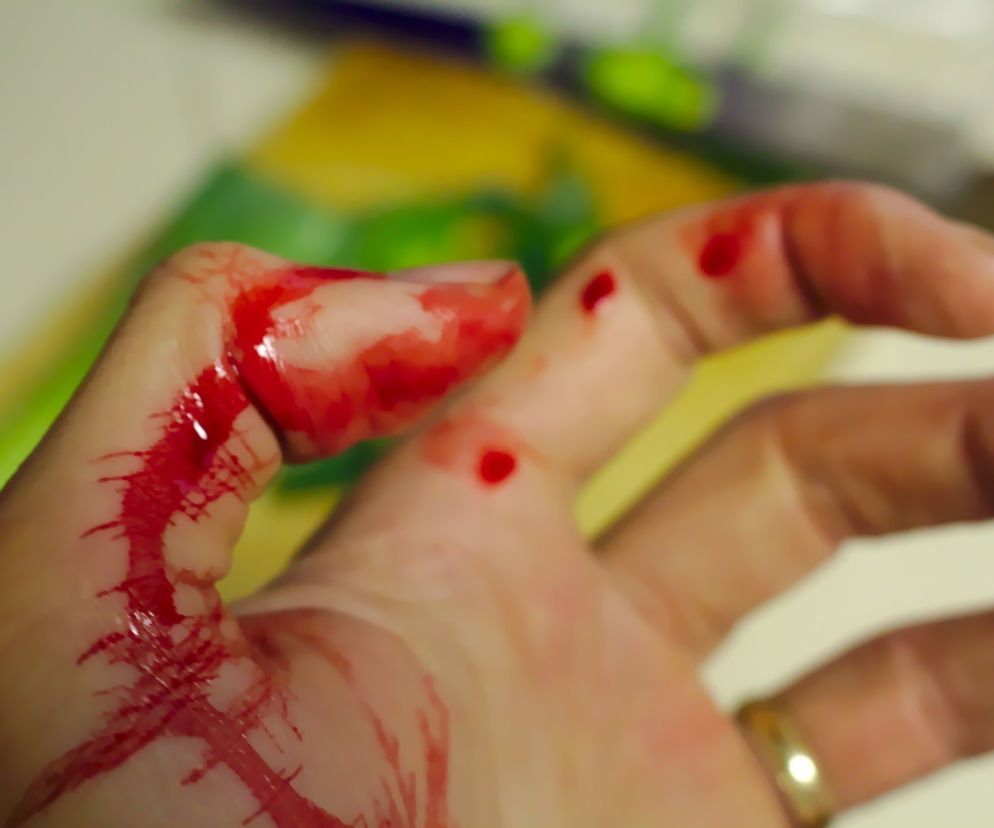 Łomża. Kobieta robiła kanapki. Zaraz później doszło do tragedii