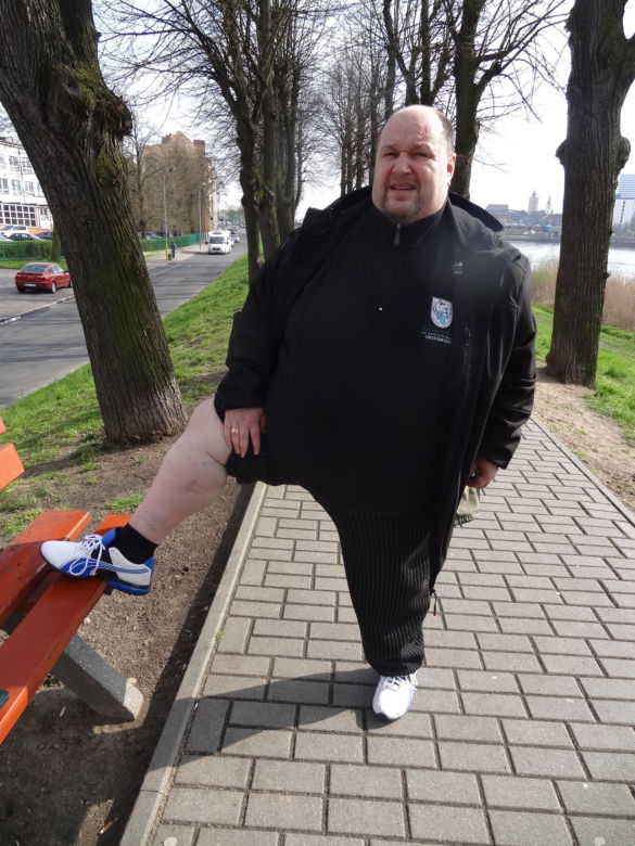 Jestem Za gruby na operację