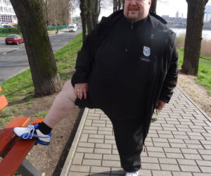 Jestem Za gruby na operację