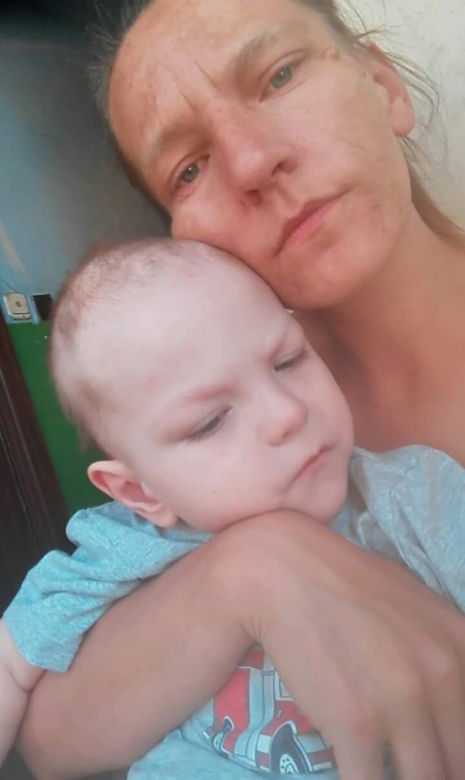 Życie pani Sylwii to droga przez mękę! Jej historia poruszyła internautów [ZDJĘCIA]