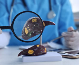 Niepozorne zakażenie może zniszczyć chorą wątrobę. HEV wciąż wymyka się diagnostyce