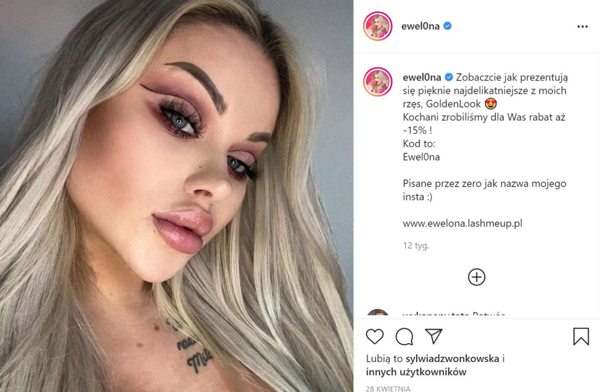 Ewelina z Warsaw Shore przesadziła z operacjami