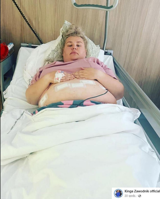 Kinga Zawodnik zmniejszyła żołądek, by schudnąć!
