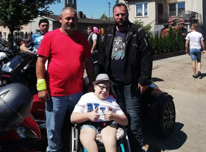 Gabryś przeszedł 17 operacji, tylko na twarzy i dłoniach nie ma blizn. Jego pają jest pomoc innym!