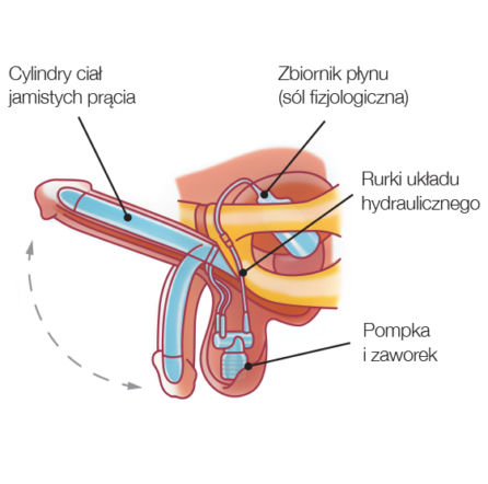 Operacja urologiczna na antenie TVN Style