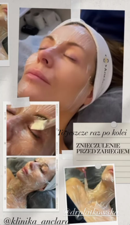 Rozenek razi twarz prądem