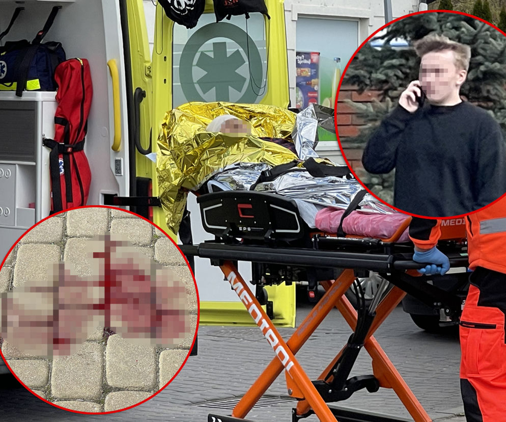 Koszmar na Bielanach. Toyota gruchnęła w pieszego. Polała się krew