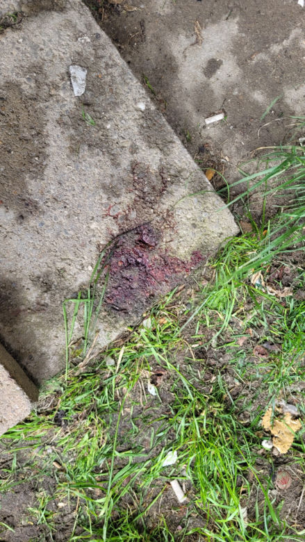 Sosnowiec: Tragiczna śmierć 13-letniego chłopca. Zginął w tajemniczych okolicznościach 