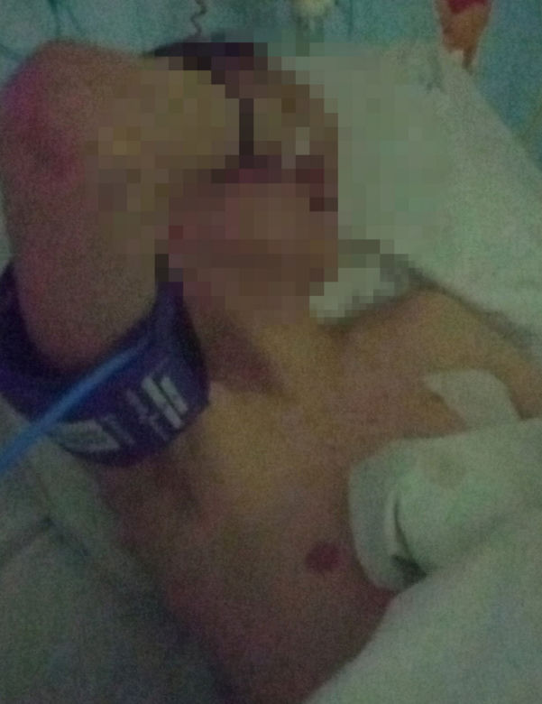 Ostrze noża minęło serce Kacpra o dwa centymetry. Zaatakował go 12-letni chłopiec