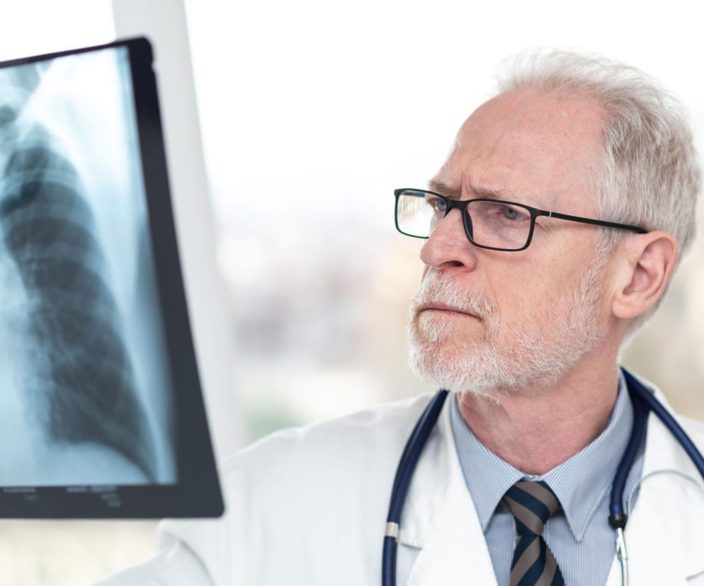 Starszy lekarz w okularach i kitlu, ze stetoskopem na szyi, uważnie analizuje zdjęcie rentgenowskie płuc. Scena symbolizuje diagnostykę i poszukiwanie wczesnych zmian nowotworowych, o czym więcej można przeczytać na portalu Poradnik Zdrowie.