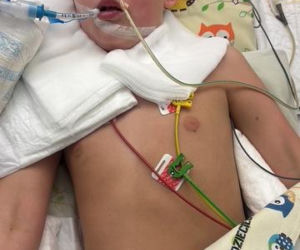 To niestety nie był zły sen… 8-letni chłopiec nagle przestał oddychać