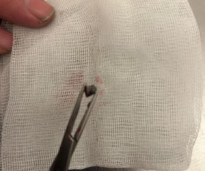 Uratowany ptak został postrzelony