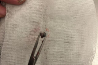 Uratowany ptak został postrzelony