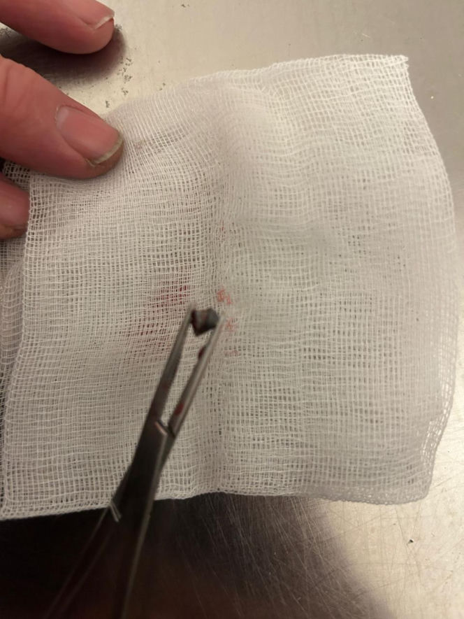 Uratowany ptak został postrzelony