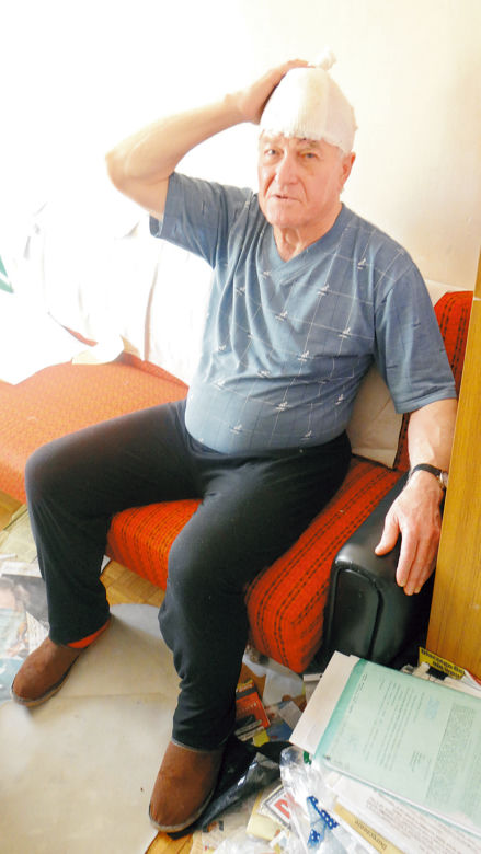 Komornik skatował mnie łomem