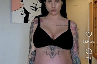 Karolina Gilon zoperowała biust. Zdjęcia przed i po