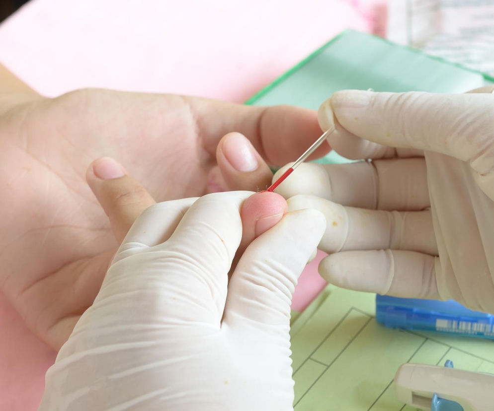 Osoba w białych rękawiczkach pobiera krew z palca pacjenta za pomocą nakłuwacza, co symbolizuje nową metodę diagnostyki Alzheimera. O możliwościach tego przełomowego testu z kropli krwi przeczytasz więcej na portalu Poradnik Zdrowie.