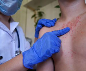 Ta choroba jest groźniejsza niż grypa. Rośnie liczba hospitalizacji. Lekarze: „Utraciliśmy odporność zbiorową”