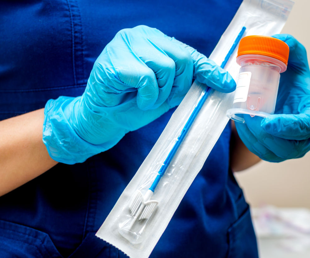 Dlaczego cytologia to ważne badanie? Wyjaśniamy, czym są grupy cytologiczne