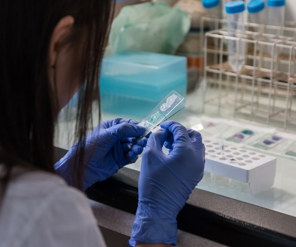 Bezpłatne badania na HIV, HCV i kiłę