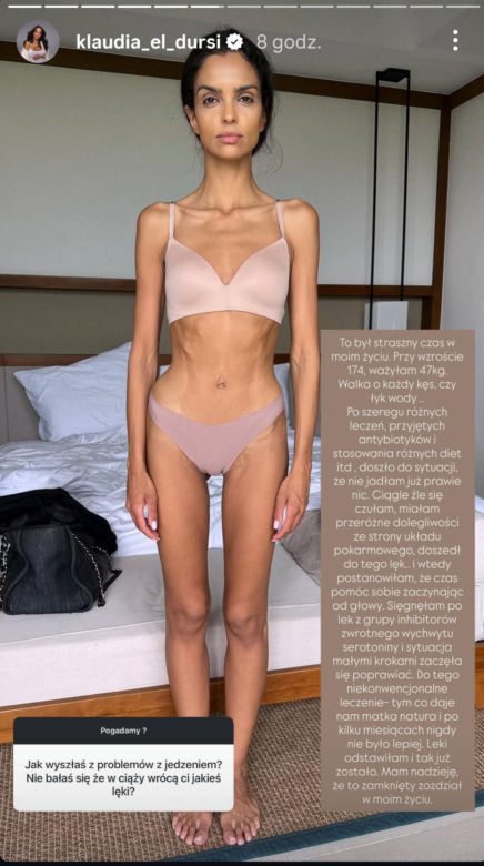 Klaudia El Dursi pokazała zdjęcie z okresu, kiedy ważyła 47 kilo! "Straszny czas"