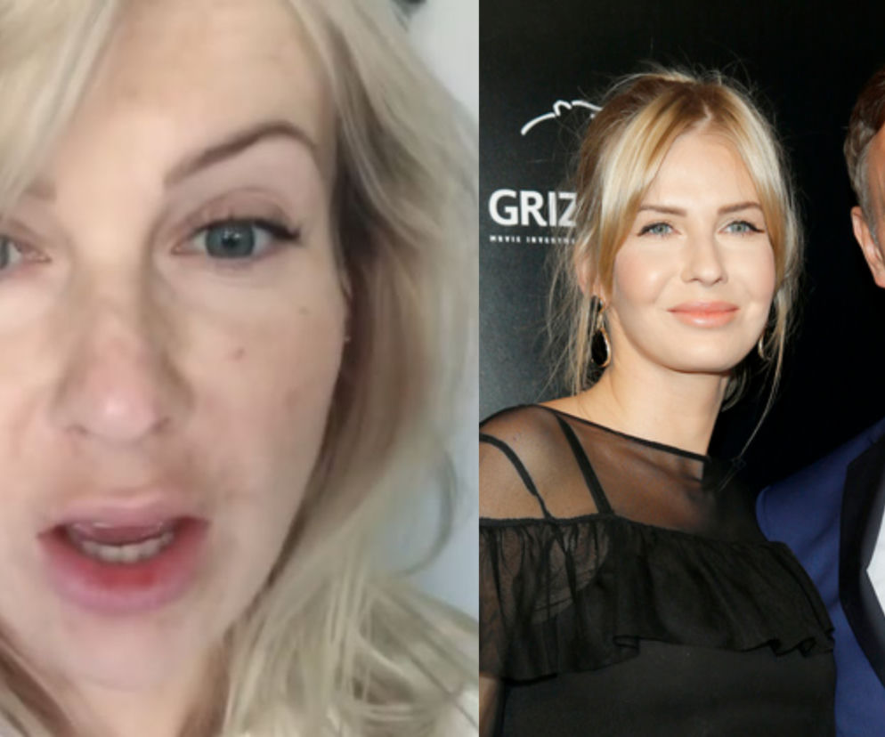 Edyta Pazura z plamami na twarzy
