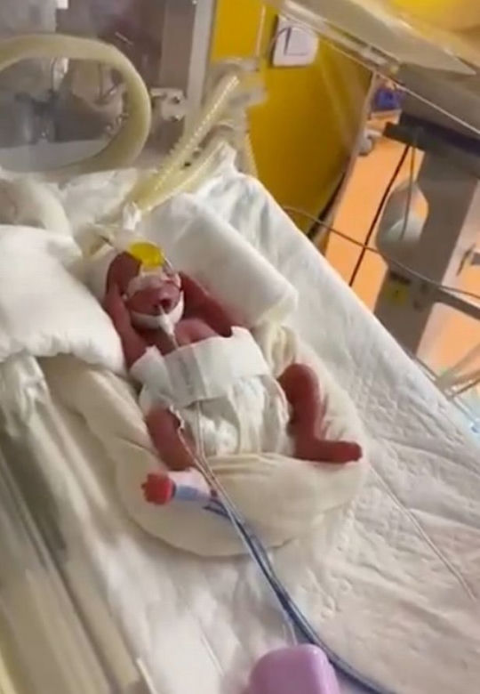 Urodziła dziewięcioraczki! Lekarze przegapili dwoje dzieci