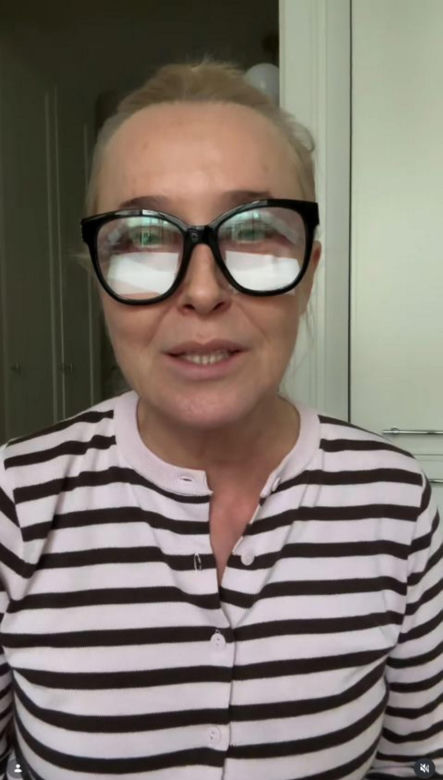 Agata Młynarska wycięła sobie powieki