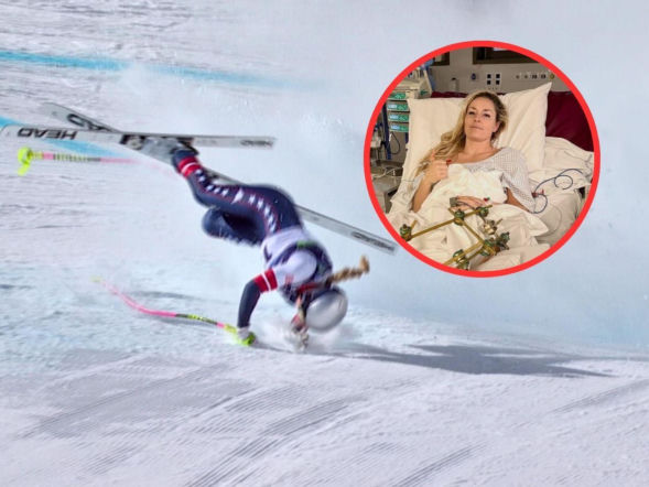 Lindsey Vonn pokazała się po koszmarnym wypadku na IO! Przeszła trzy operacje [ZDJĘCIA]