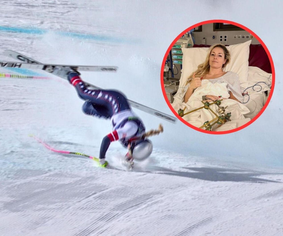 Lindsey Vonn przeszła serię operacji. Pokazała się po koszmarnym wypadku na igrzyskach