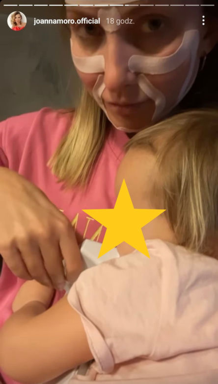 Co Joanna Moro zrobiła z twarzą?