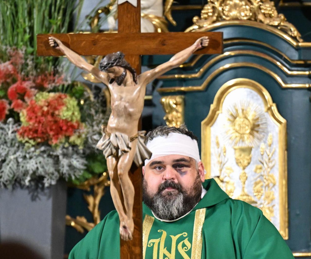 Ranny ksiądz z bandażem na głowie i siniakiem pod okiem odprawia mszę. O tragedii w Jarosławiu pisze Eska Rzeszów.