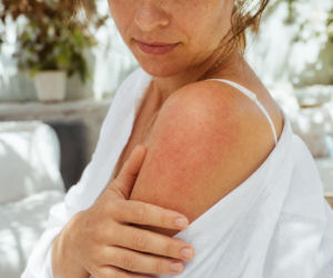 Swędząca wysypka po słońcu bywa sygnałem fotodermatozy. Czas reakcji zdradza typ problemu