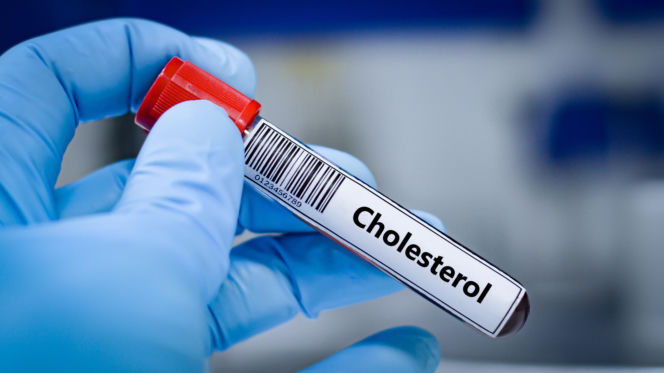 Cholesterol