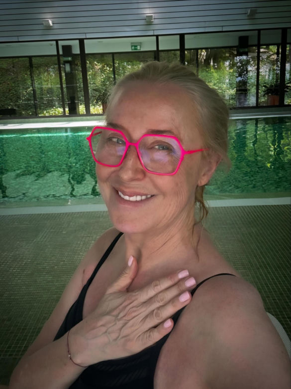 Agata Młynarska wycięła sobie powieki