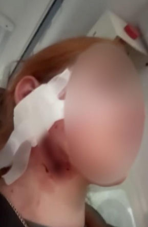 Brutalne pobicie młodej pary we Wrocławiu. Rodzina opublikowała wstrząsające nagranie