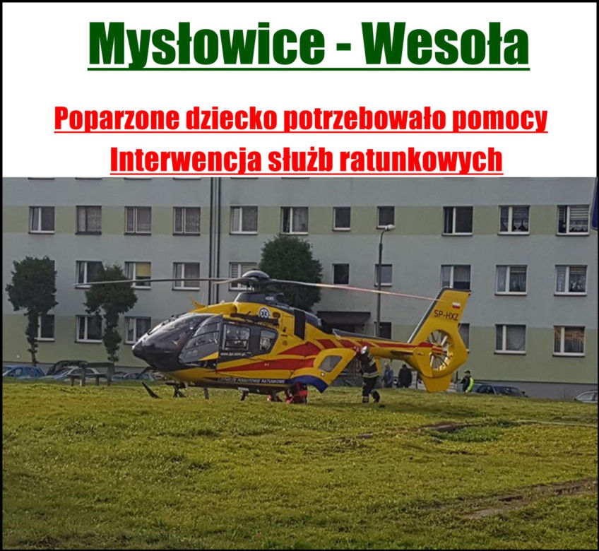 MYSŁOWICE: Poparzony 2-latek trafił śmigłowcem do szpitala!