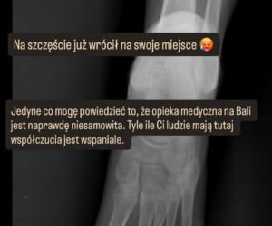 Żona Piotra Adamczyka miała groźny wypadek! Tak się skończył ich wypad na Bali