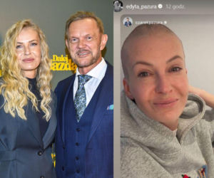 Gwiazdy zgoliły głowy w szczytnym celu