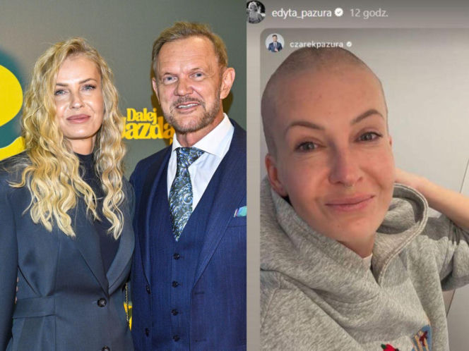 Gwiazdy zgoliły włosy w szczytnym celu