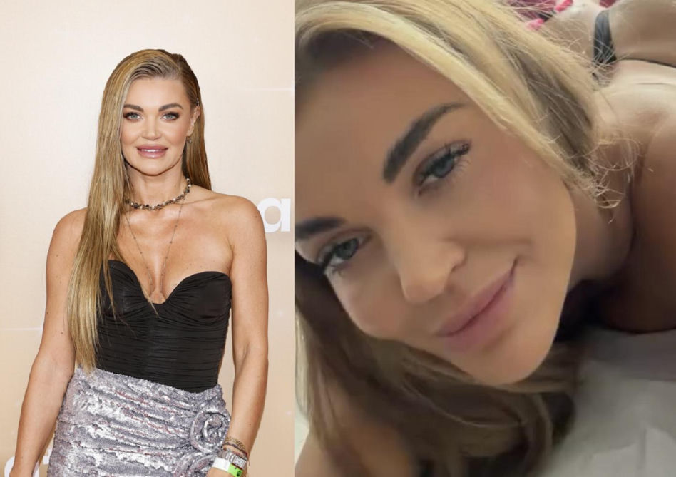 Edyta Folwarska pokazała zabieg na pośladki